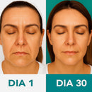 Massageador Facial com Fototerapia Anti-Rugas
